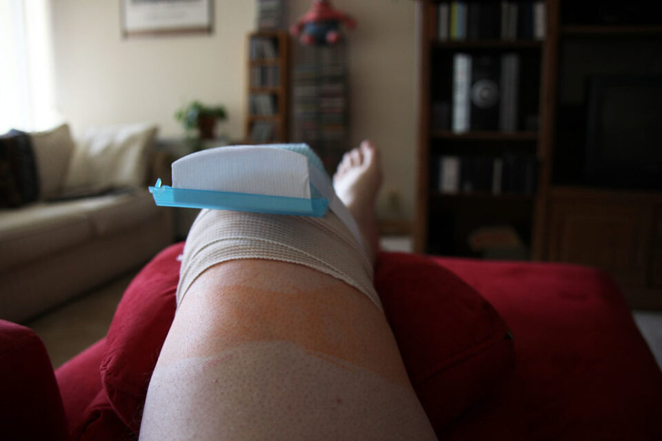 Meeting the rising demand for medical implants